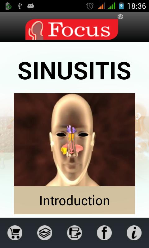 Sinusitis