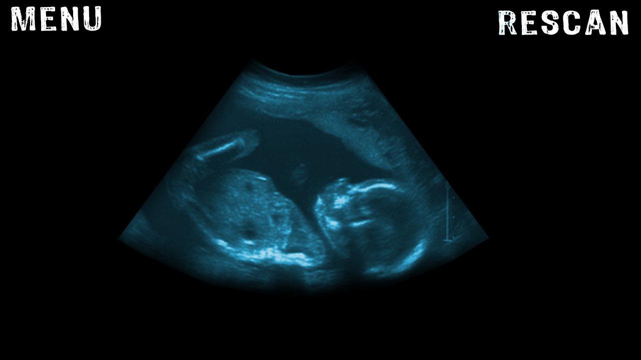 Scanner X-Ray Ultrasound Joke